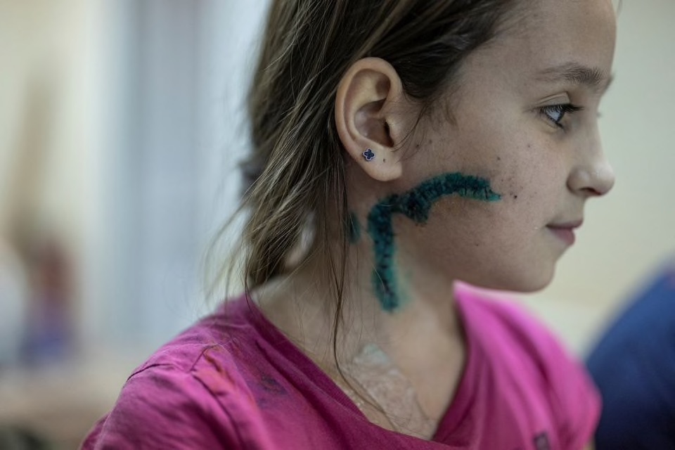 UKRAINE DES ENFANTS VICTIMES D&rsquo;UNE GUERRE AVEUGLE